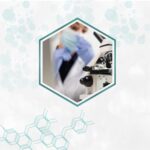 تحليل الغدة الدرقية TSH