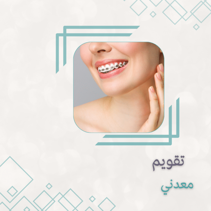 ⁦تقويم الأسنان المعدني نقدي خصم الطلاب  يشمل (المقاسات – الأشعة – الخطة العلاجية) (عرض خاص خصم 40%على علاجات الاسنان) (متابعة مجانية لمدة سنة)⁩ - الصورة ⁦1⁩