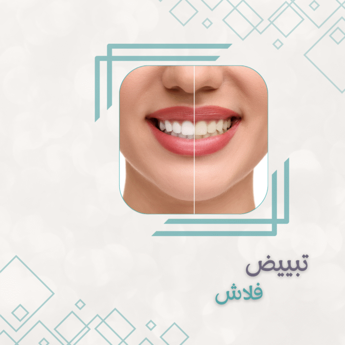 44 تبييض الأسنان فلاش + تنظيف اسنان مجانا - الصورة 1