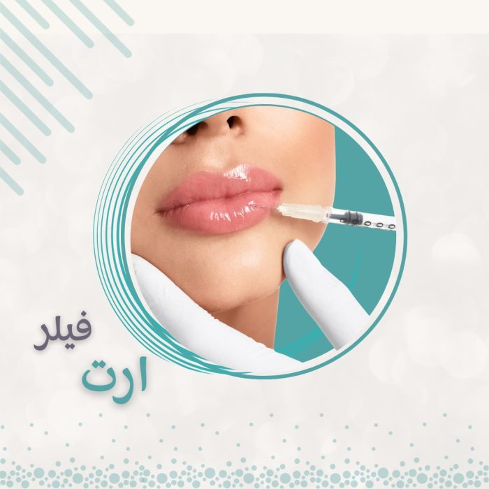 WhatsApp Image 2025-08-19 at 12.19.17_e272b335 1مل فيلر أرت  الفرنسي - الصورة 1