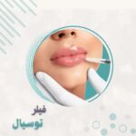 مل فيلر توسيال سويسري