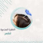 الخلايا الجذعية للشعر
