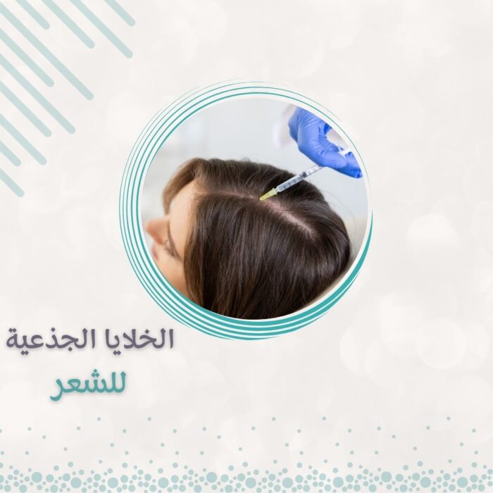 ⁦الخلايا الجذعية للشعر⁩ - الصورة ⁦1⁩