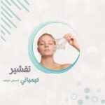 تقشير كيميائي