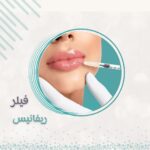 1مل فيلر ريفانيس كندي