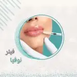 1مل فيلر نوفيا