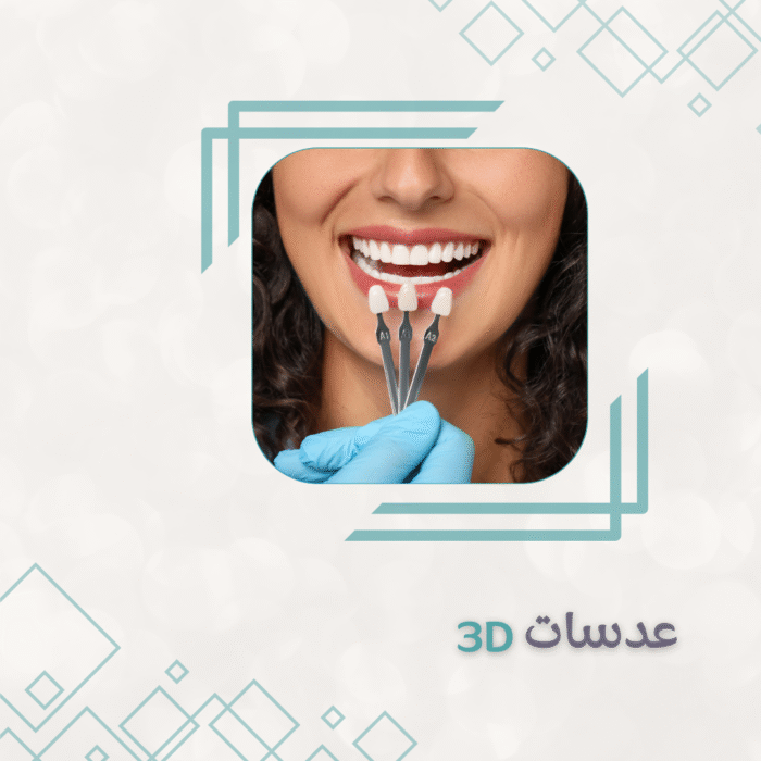 40 8عدسات فينير - الصورة 1